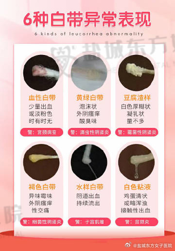 科技重塑女性健康管理新篇章，最新白带图片解析