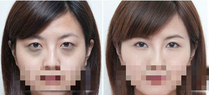 深度分析观点阐述